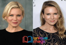 Renee Zellweger Plastic Surgery