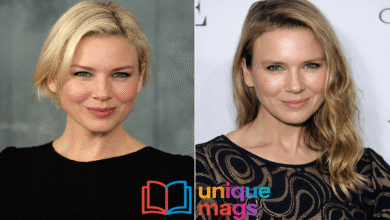Renee Zellweger Plastic Surgery